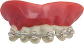 Dentier Appareil Dentaire / La Maison Du Déguisement